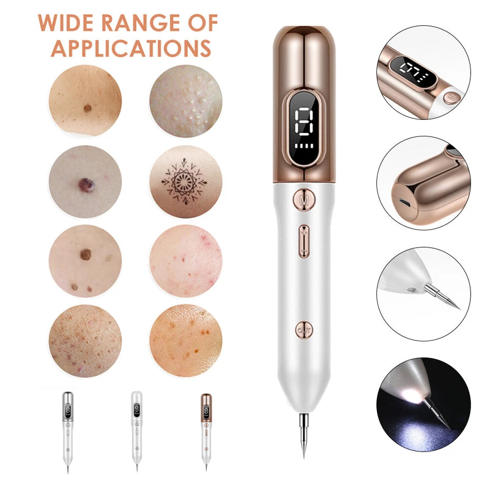 Plasma Skin Tag & Dark Spot Removal Beauty Pen - Marianas Artistry