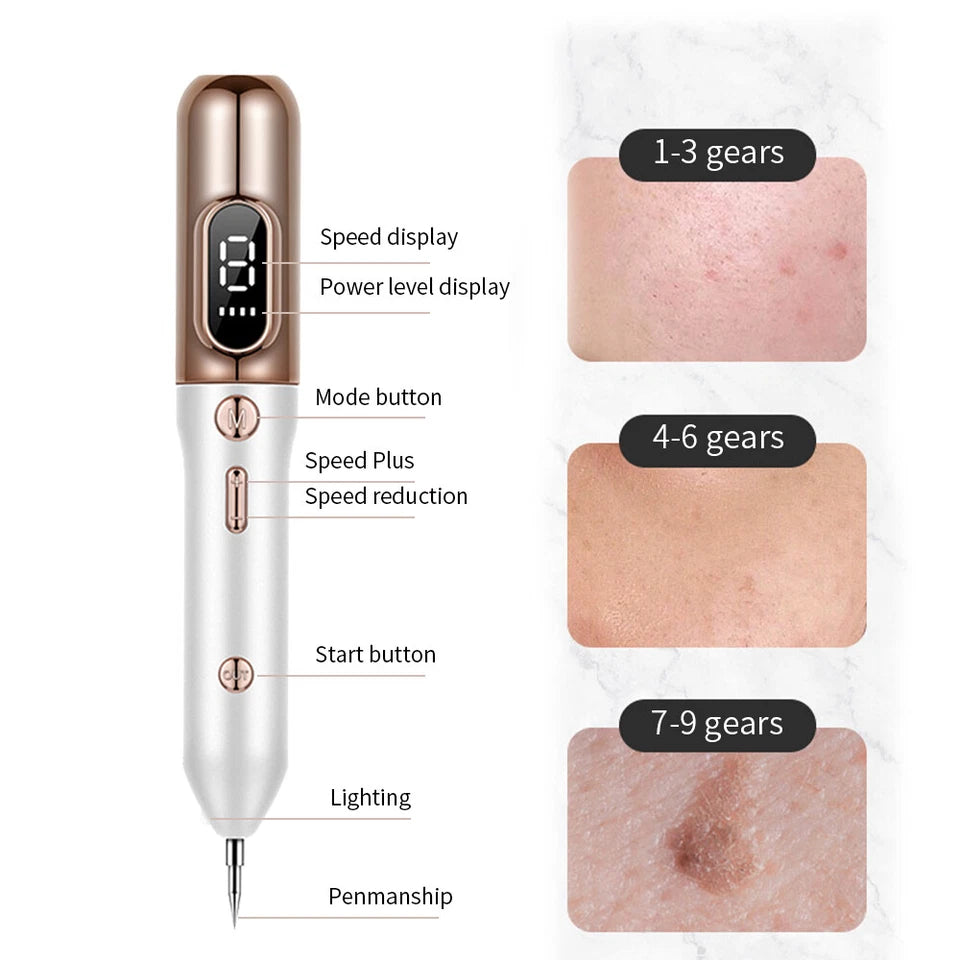 Plasma Skin Tag & Dark Spot Removal Beauty Pen - Marianas Artistry