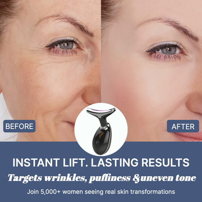 GlowLift™ - Age Defying Facelift